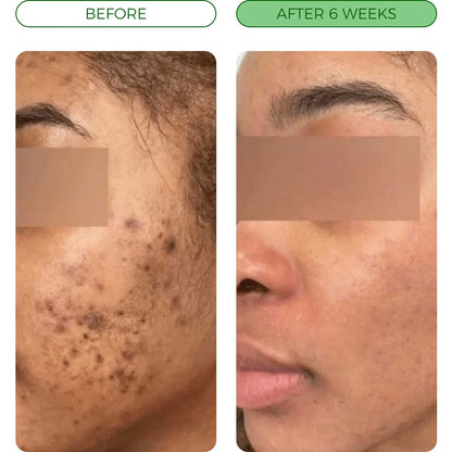 NAIA Turmeric Fade & Glow Bar shown in before and after images highlighting skin brightening and even tone results.