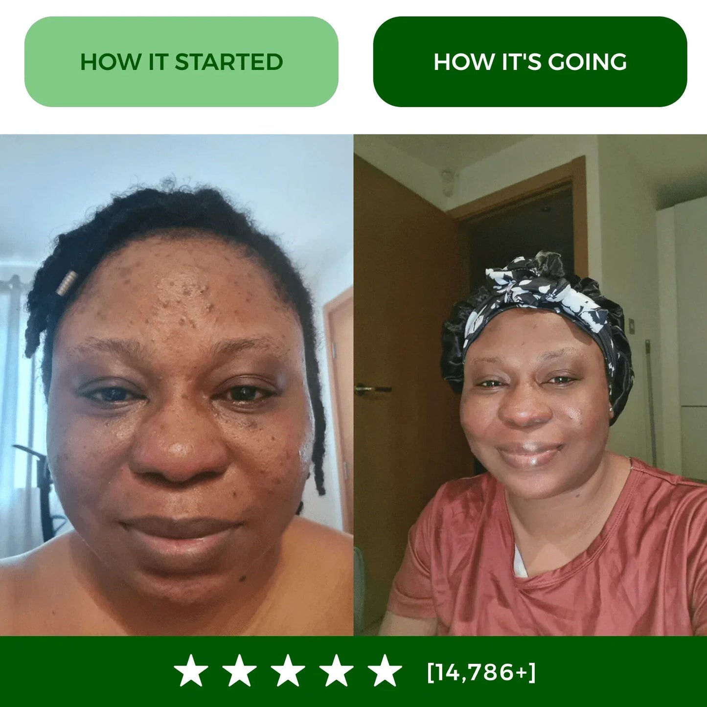 NAIA Turmeric Fade & Glow Bar showing before and after skin brightening results on light skin.